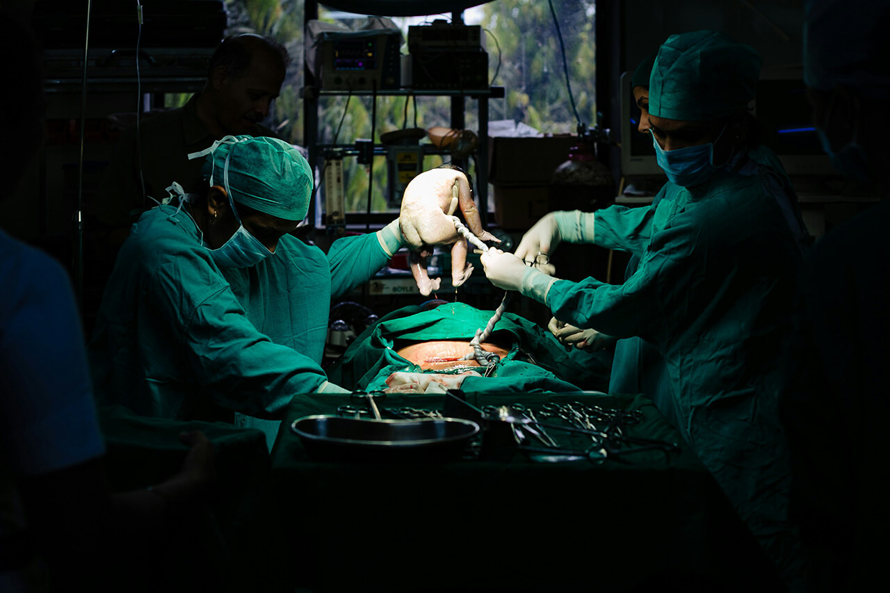 Photo by Amit Gaur on Unsplash Caesarean Birth